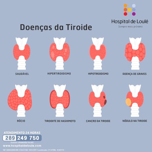 Thyroid: warning signs